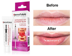 Dermofuture precision GLASS GLOW LIP FILLER huuliseerumi 12ml
