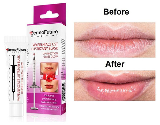 Dermofuture precision GLASS GLOW LIP FILLER huuliseerumi 12ml