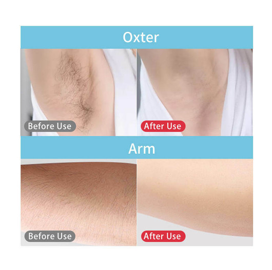 IPL Mini Karvanpoistolaite – Tehokas kotilaite näytöllä