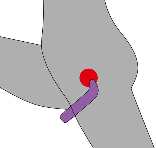 G – PISTEEN HIEROJA