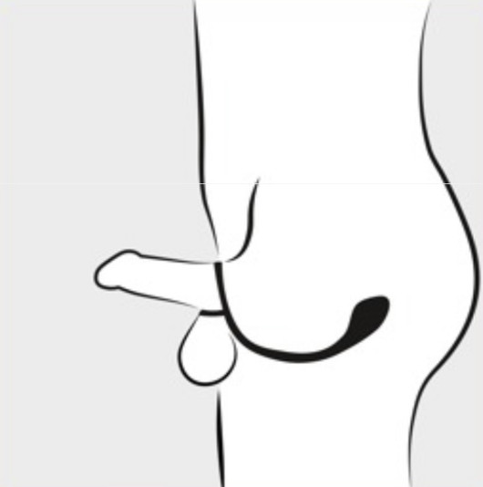 Penis-ja kivesrengas anaalitapilla