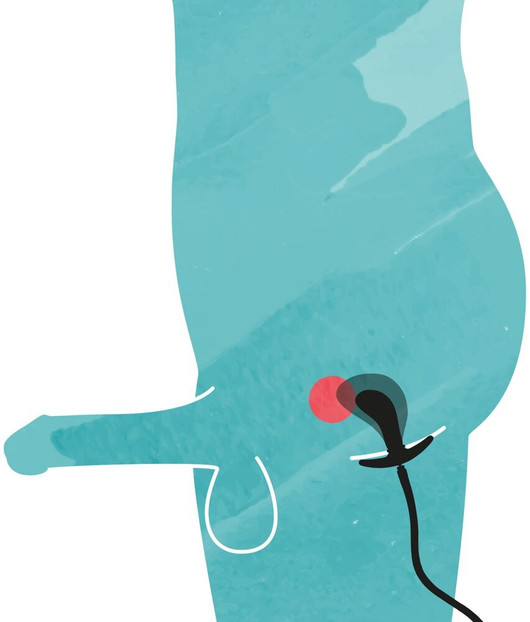 Iso, isompi, pumpattava anaalitappi - Ilmalla täytettävä anustappi